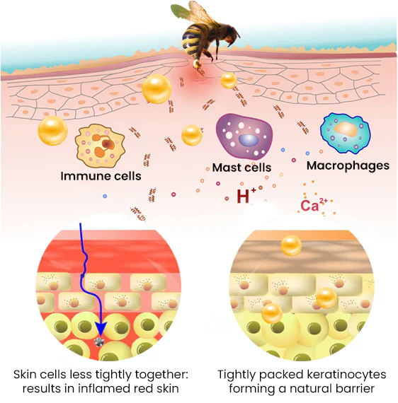 NutRelief™ Bee Venom Eczema Treatment Cream